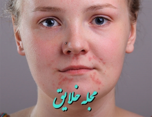 آموزش روتوش صورت در فتوشاپ