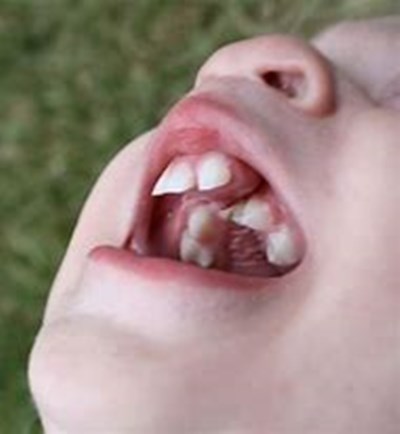 لب شکری